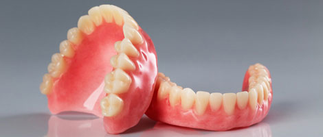 Dentaduras completas sobre implantes