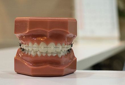 Ortodoncia Funcional Estética EndoAvanzada