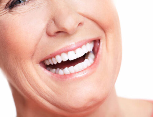 Dentaduras Completas sobre Implantes