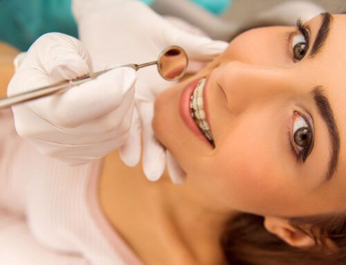 5 Datos sobre la Ortodoncia con Brackets