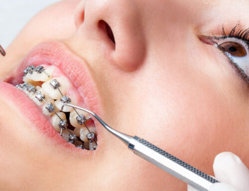 Implantes Ortodónticos