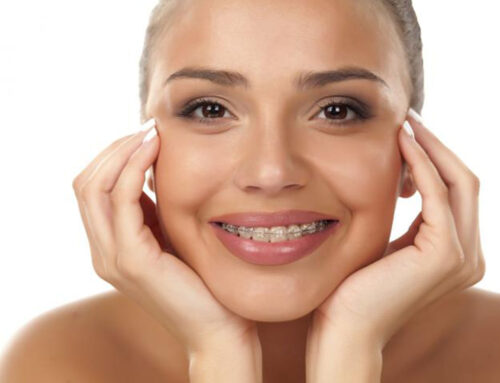 Ortodoncia Funcional y Estética