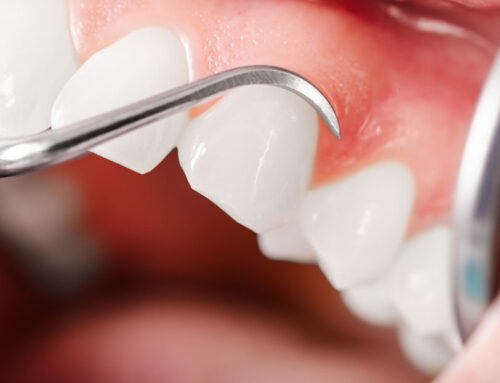 ¿Qué es la Periodoncia?